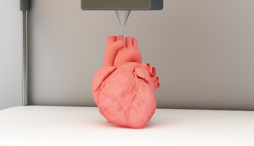 醫(yī)學(xué)3d打印重建女子頭骨